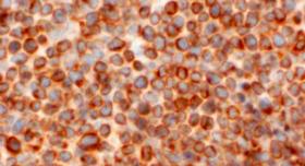 2018年5月4-5日（芝加哥）第15届国际Ultmann芝加哥淋巴瘤研讨会