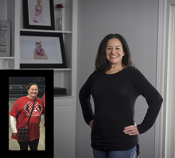 在新的门诊手术帮助下，忙碌的咨询师成功瘦身