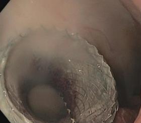 2019年4月12-13日（芝加哥）芝加哥大学直播！2019年内镜技术在临床实践中的进展