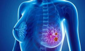 2019年10月18-19日（芝加哥）	2019芝加哥乳腺与淋巴水肿研讨会